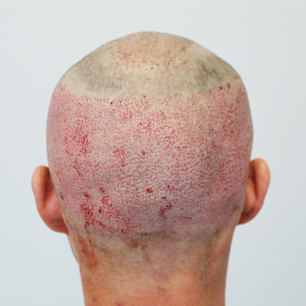 14.thumb.jpg.2b819381118e5d92013e63ad41f73206